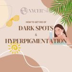 How to reduce dark spots and hyperpigmentation
