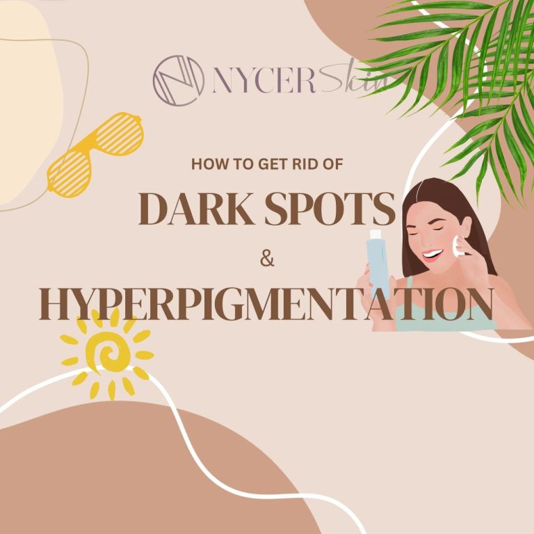 How to reduce dark spots and hyperpigmentation