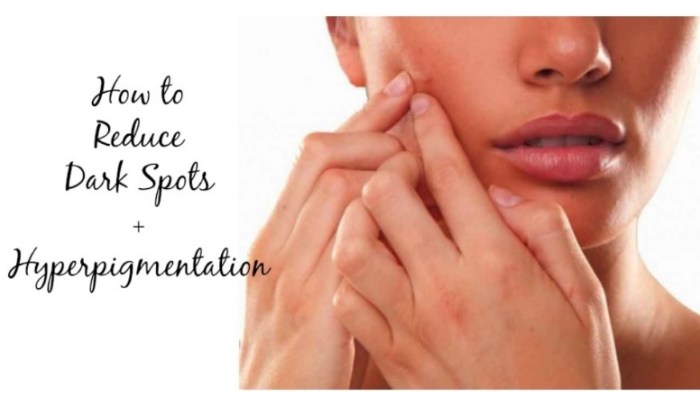 How to reduce dark spots and hyperpigmentation